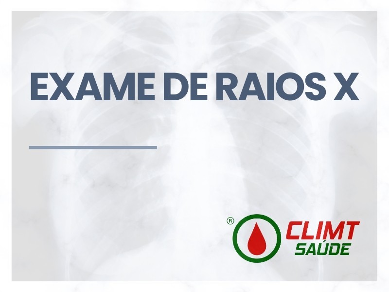 Exame de Raios X em Goiânia