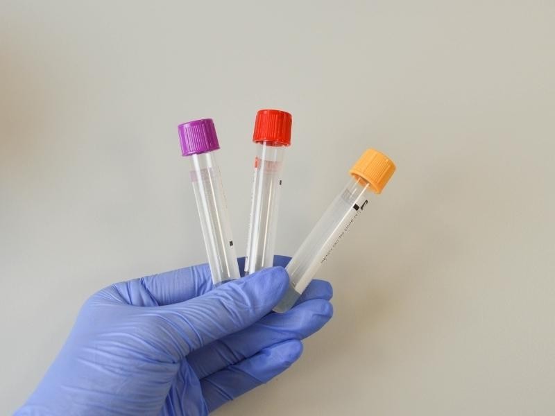Exame de Hormônios Masculinos e Metabolismo em Goiânia