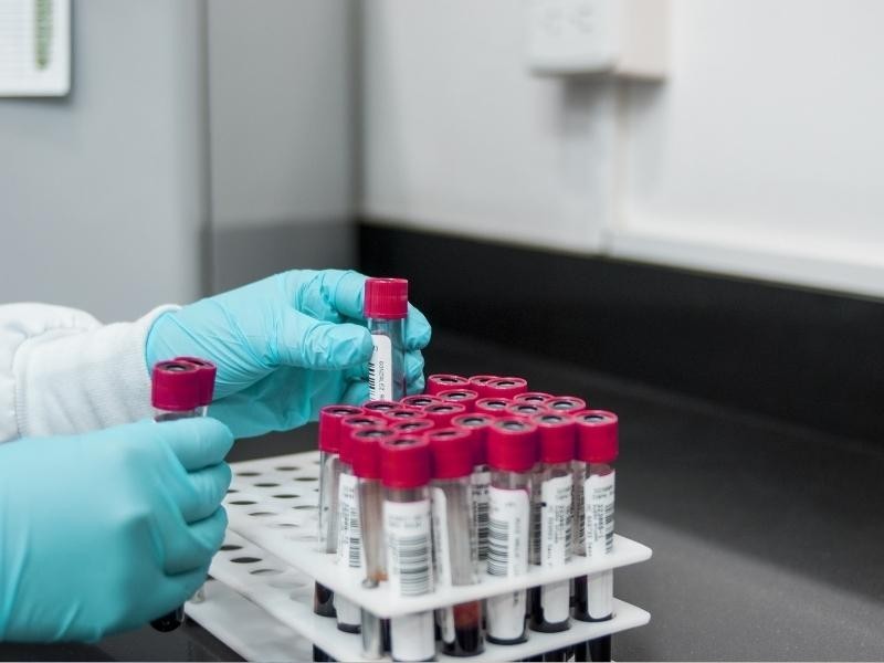 Exame de Biologia Molecular e Painéis Respiratórios em Goiânia