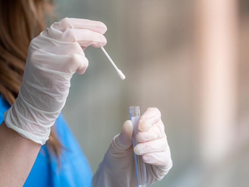 Swab de Superfícies para Controle de Higiene em Iporá