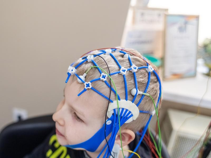 Eletroencefalograma (EEG) — Adulto, Criança e Modalidades Especiais