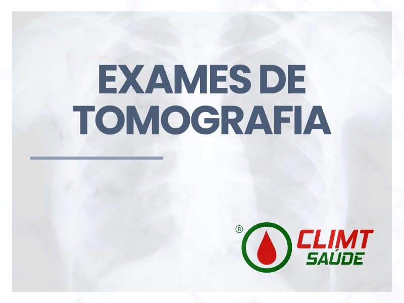 Exame de Tomografia em Goiânia