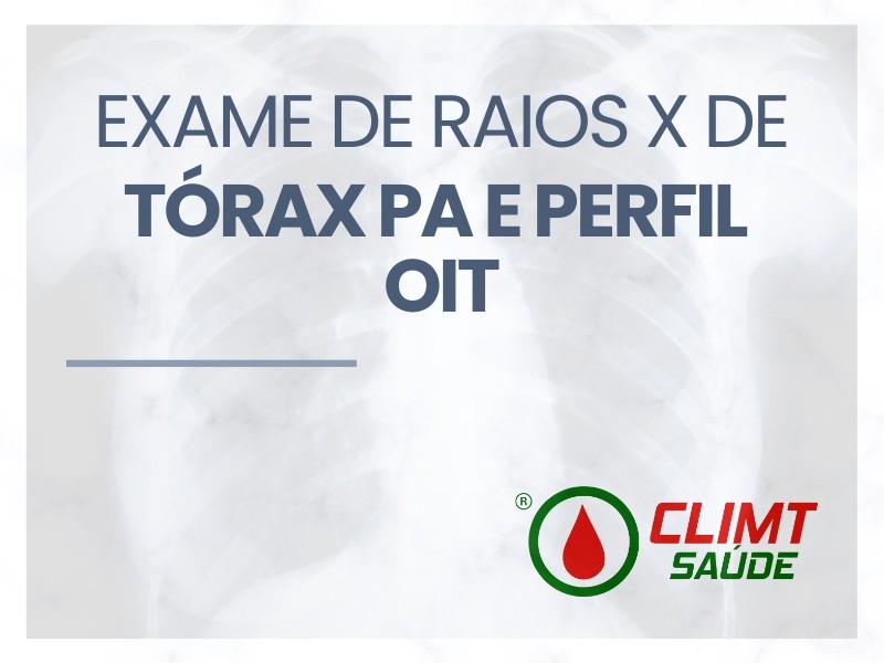 Exame de Raios X de Tórax PA e Perfil OIT em Goiânia
