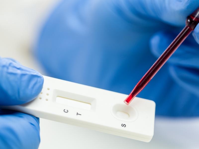 Sorologias e Exames Infecciosos