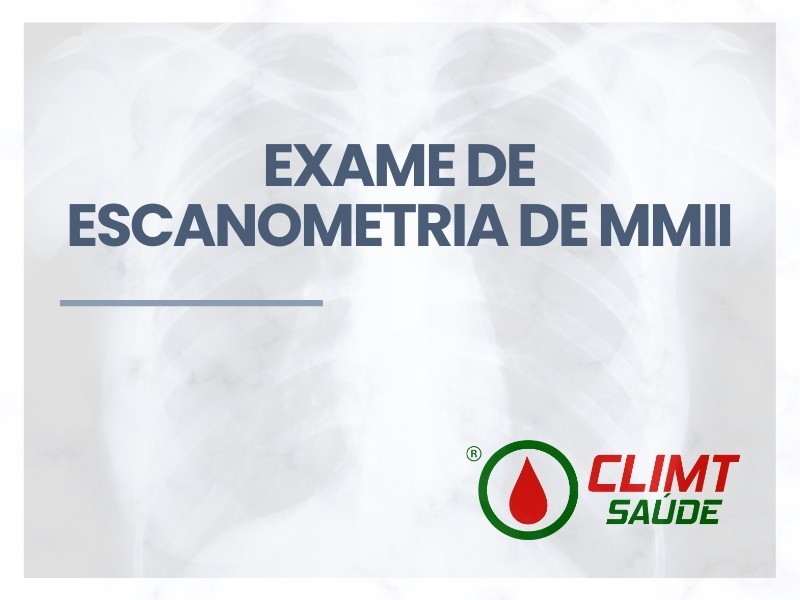 Exame de Escanometria de MMII em Goiânia