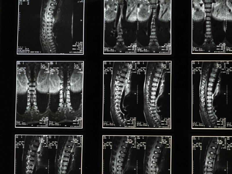 Raio X de Coluna Cervical, Dorsal e Lombo-Sacra em Goiânia
